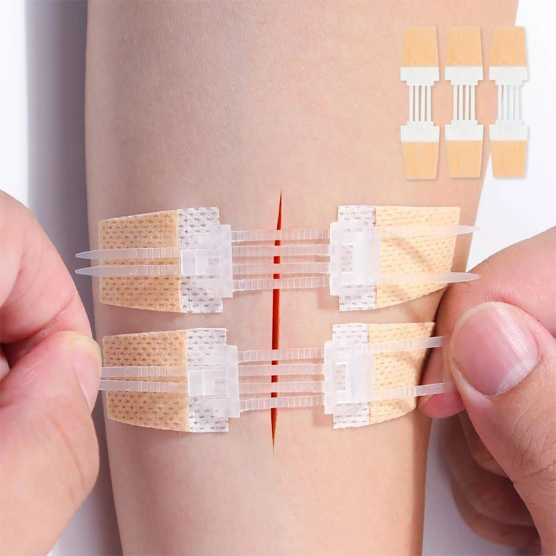 Zipper Band-aid Painless Wound Closure Patch Suture-free Wound Dressing…